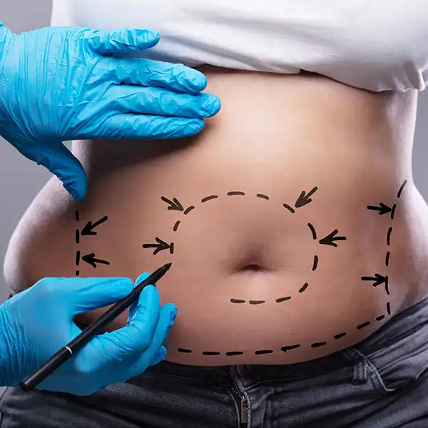 Lifting abdominal circular