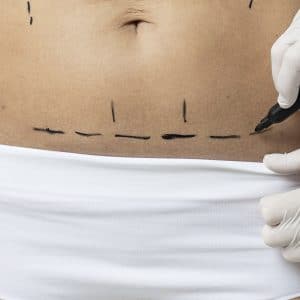 Lifting abdominal circular