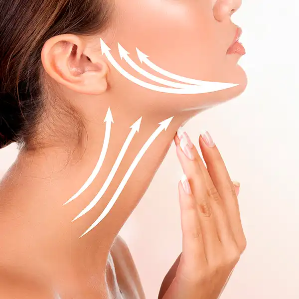Lifting cervico-facial