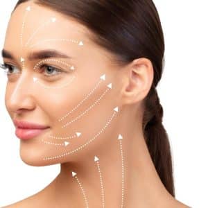 Lifting cervico-facial