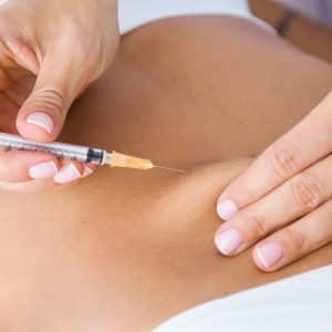 Lipoliza injectabilă
