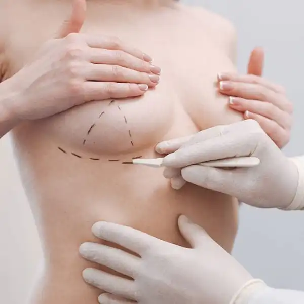 Mastopexie de reducție cu implant