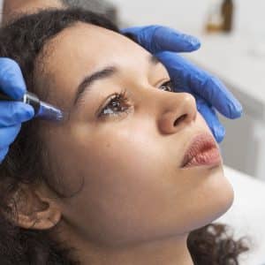 Microneedling