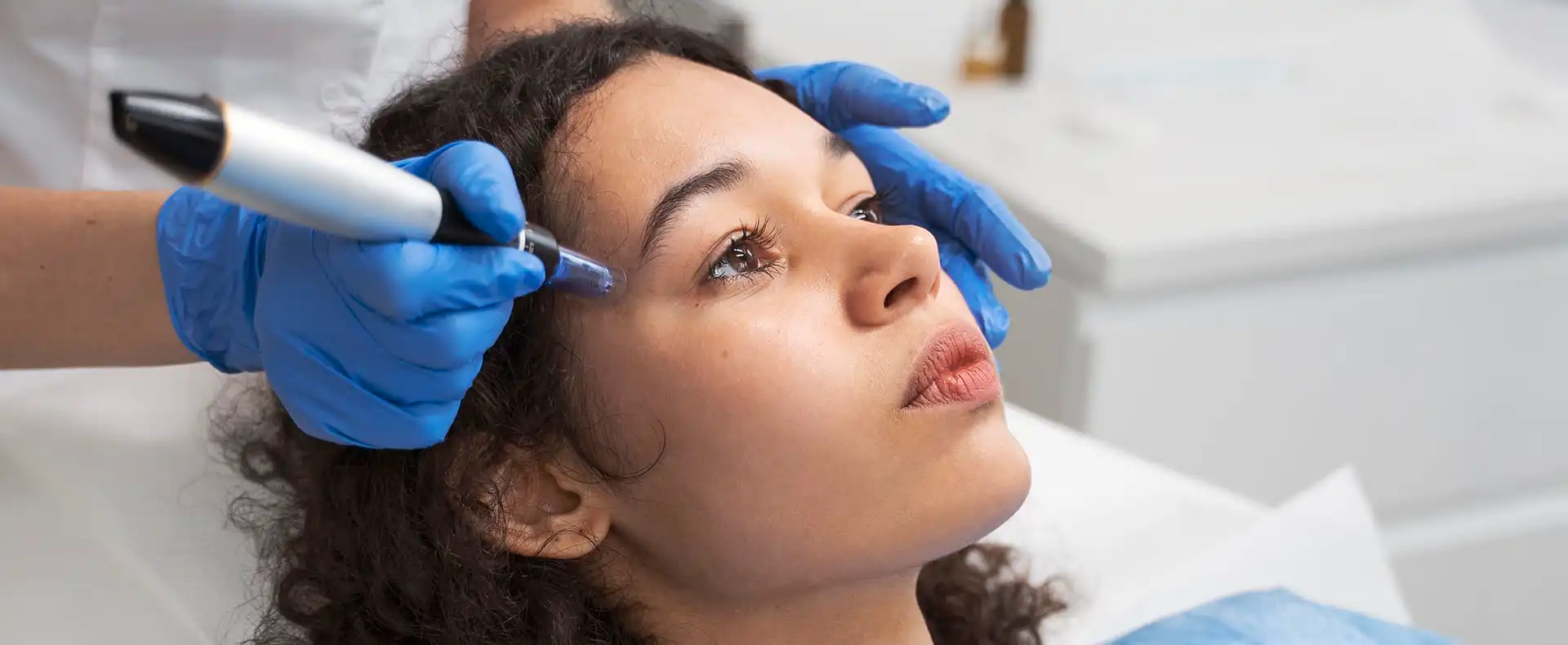 Microneedling