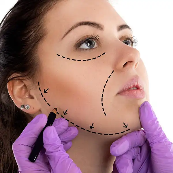 Minilifting facial