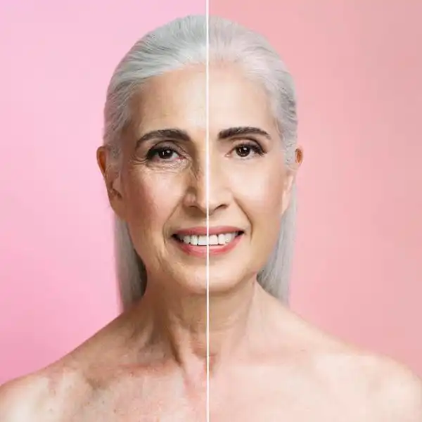 Sculptra