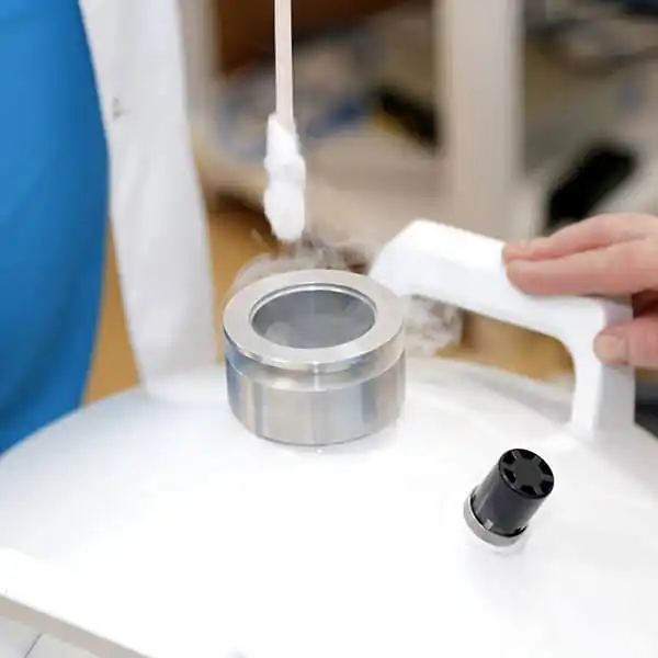 Crioterapie leziuni mucoasă genitală