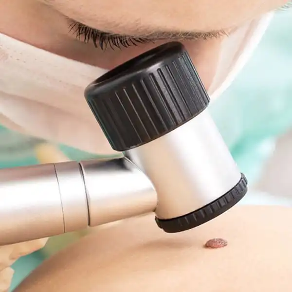 Dermatoscopie
